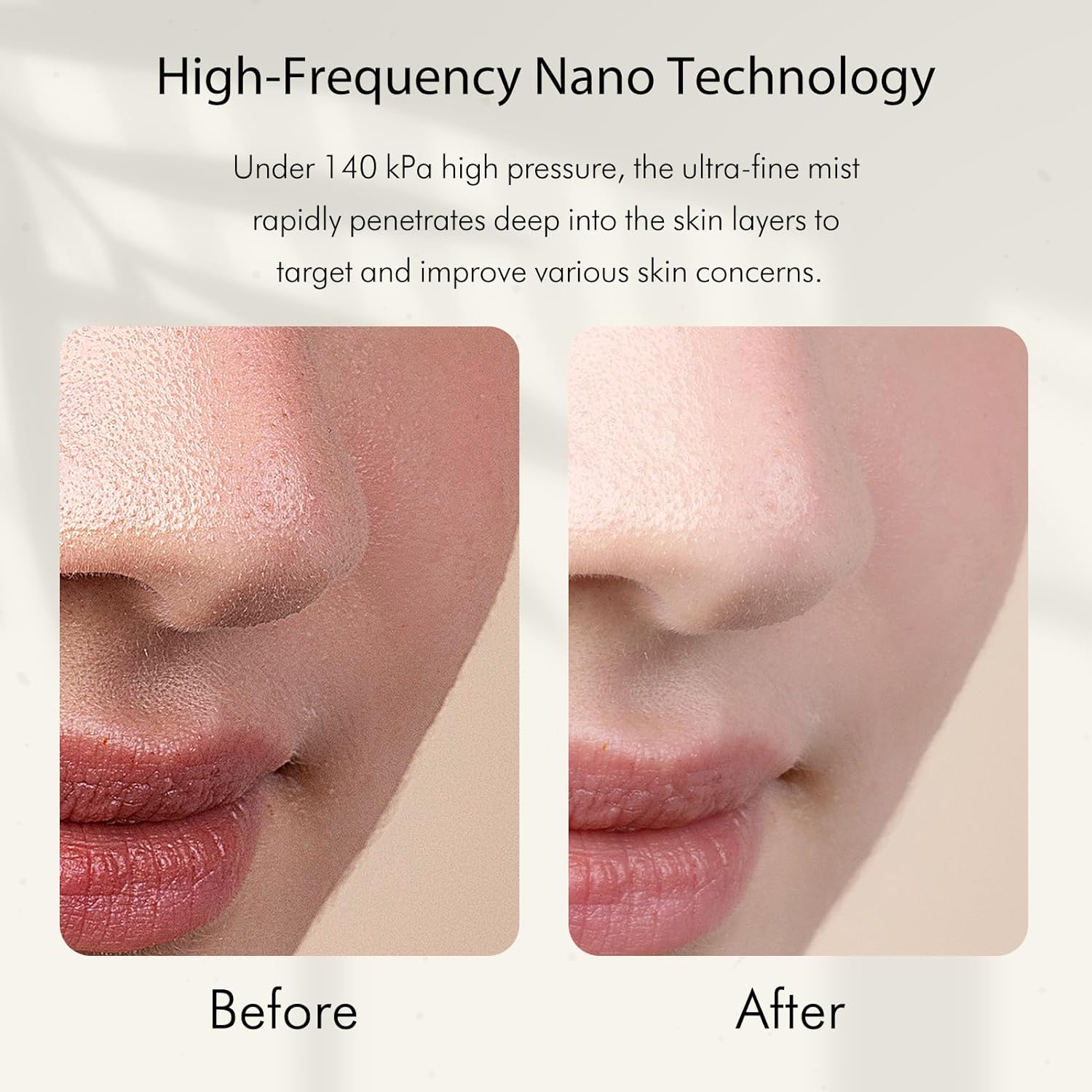 Nano İyonik Soğuk Buharlı Yüz  - Face Steamer incelemesi ve fiyatı